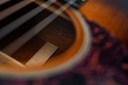 Martin D18GE Sunburst 2007-12.jpg