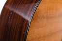 Martin OM21 Indian Rosewood Sitka Spruce 1993-20.jpg