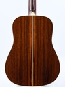 Martin D28 Limited Edition 75th Anniversary 2009-6.jpg