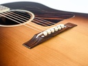 Gibson AJ Luthiers Choice Adirondack IRW 2015-10.jpg