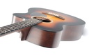 Martin OMC-10E Modern Burst-8.jpg